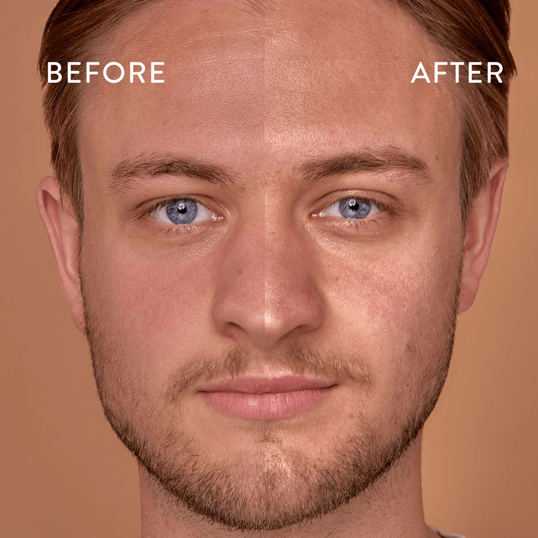Mans face before and after using Bog Myrtle and Lime Balancing Cleanser.

