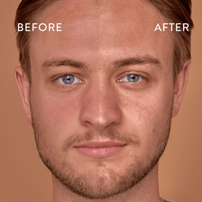 Mans face before and after using Bog Myrtle and Lime Balancing Cleanser.

