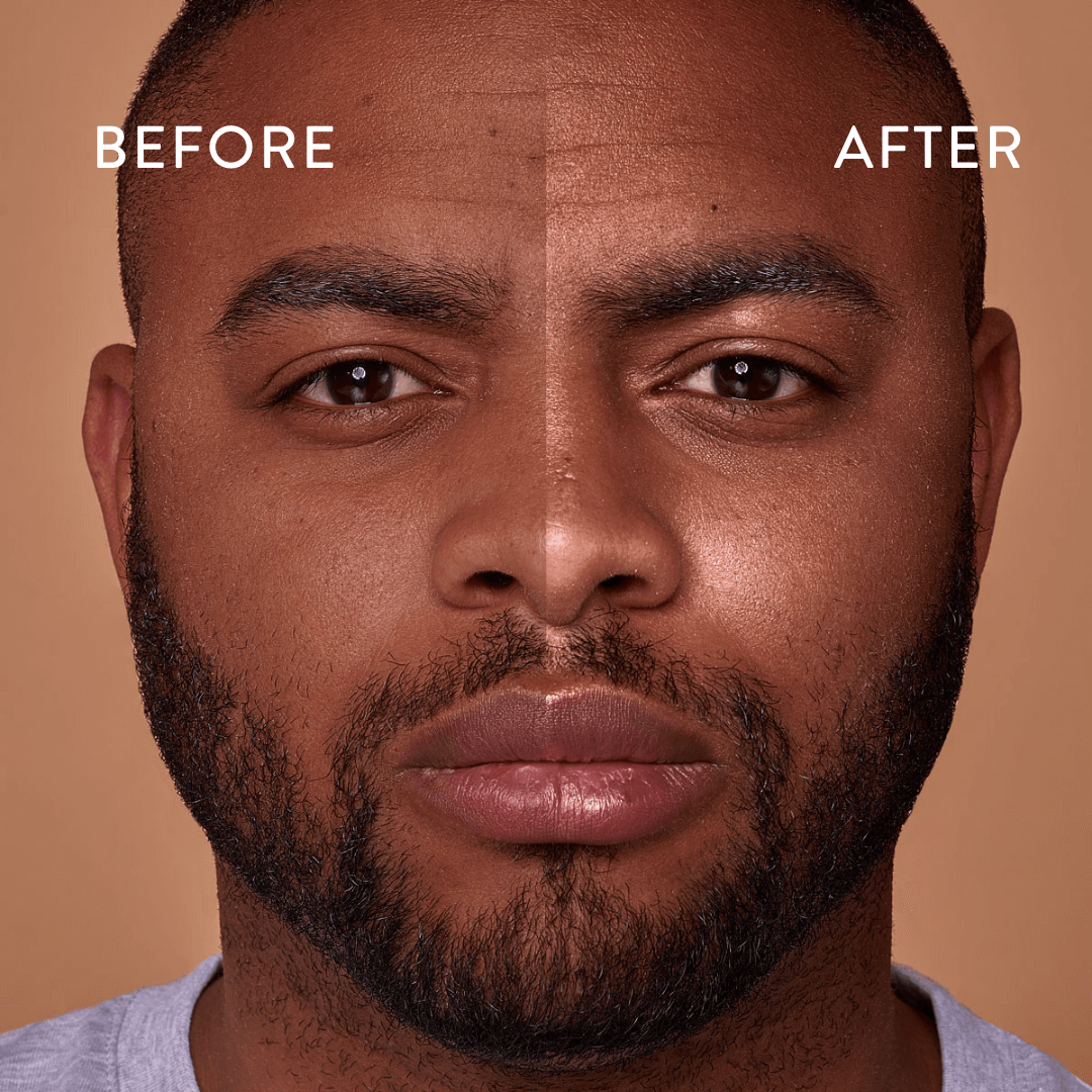 Before and after Bog Myrtle & lime cleanser on a man for men and women unisex - oil balancing and toning