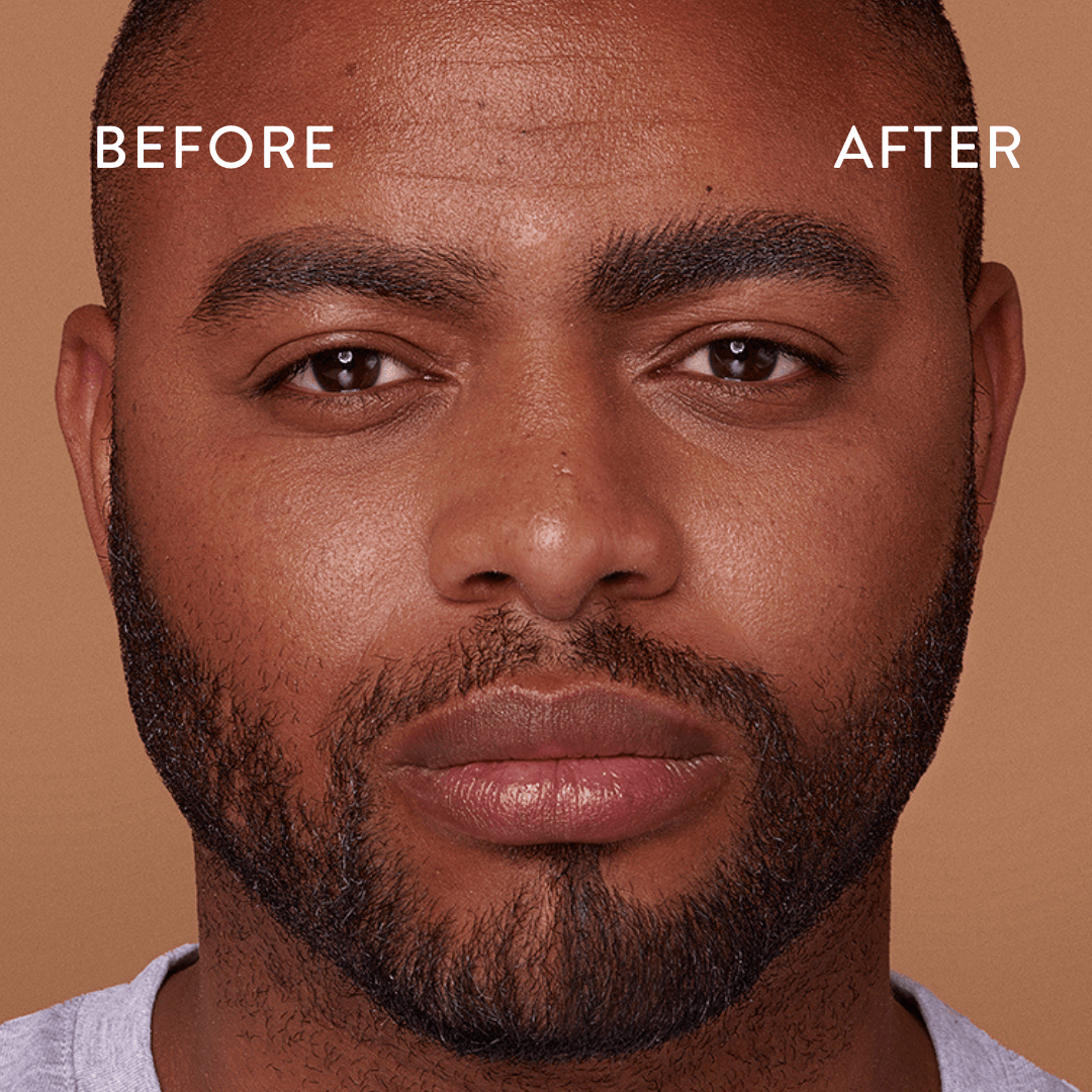 Before and after eyebrow application on mens face. WBCo Pen
