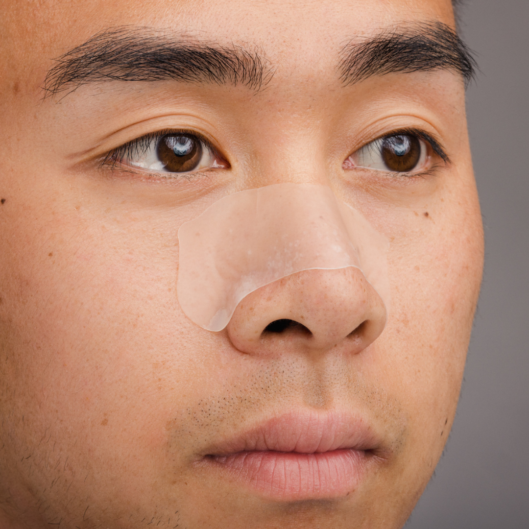 Hydra patch on asian male face