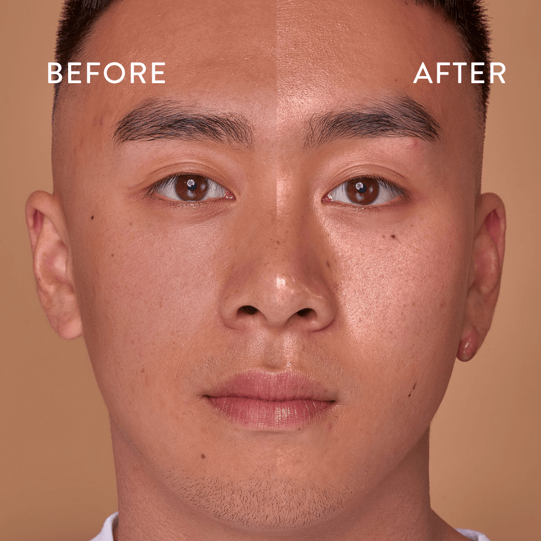 Mans face before and after using Bog Myrtle and Lime Balancing Cleanser.